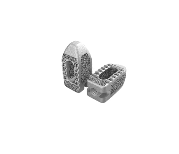 How 3D Printing Is Driving Better Outcomes in Posterior Lumbar Interbody Fusion