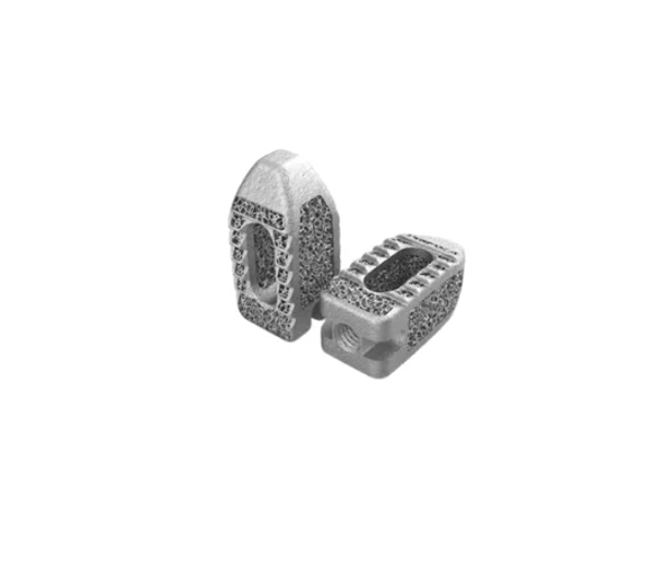 How 3D Printing Is Driving Better Outcomes in Posterior Lumbar Interbody Fusion